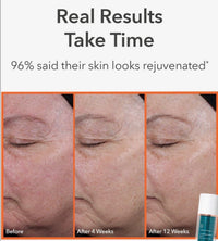 Dr. Dennis Gross DRx BioRejuvenation™ Serum 30 ml