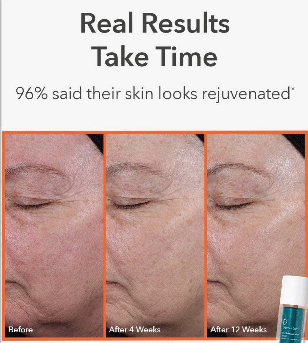 Dr. Dennis Gross DRx BioRejuvenation™ Serum 30 ml
