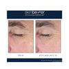 SkinBetter Science EyeMax AlphaRet Overnight Cream 15 ml