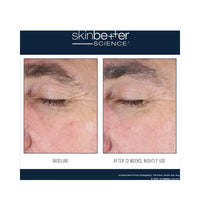 SkinBetter Science EyeMax AlphaRet Overnight Cream 15 ml