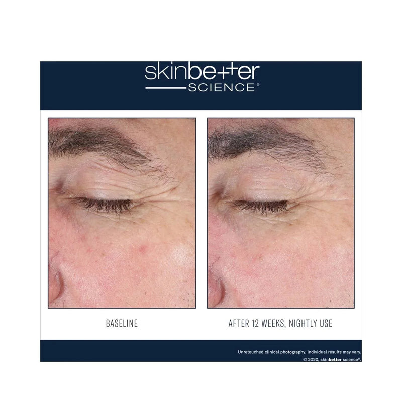 SkinBetter Science EyeMax AlphaRet Overnight Cream 15 ml