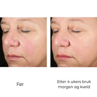 SkinBetter Science Alto Advanced Defense and Repair Serum