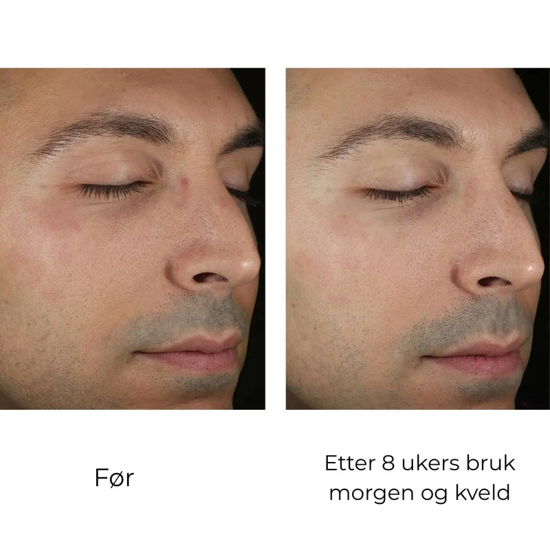 SkinBetter Science Solo Hydrating Defense MEN 50 ml