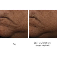 SkinBetter Science InterFuse Treatment Cream FACE & NECK 30 ml