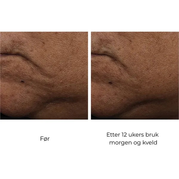 SkinBetter Science InterFuse Treatment Cream FACE & NECK 30 ml