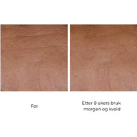 SkinBetter Science InterFuse Treatment Cream FACE & NECK 30 ml