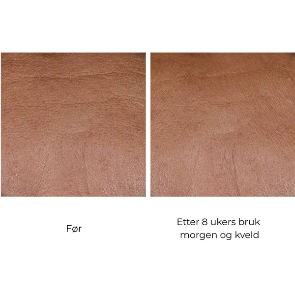 SkinBetter Science InterFuse Treatment Cream FACE & NECK 30 ml