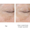 SkinBetter Science InterFuse Treatment Cream EYE 15 ml