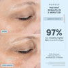 NuFACE FIX® Line Smoothing Device