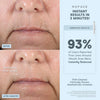 NuFACE FIX® Line Smoothing Device